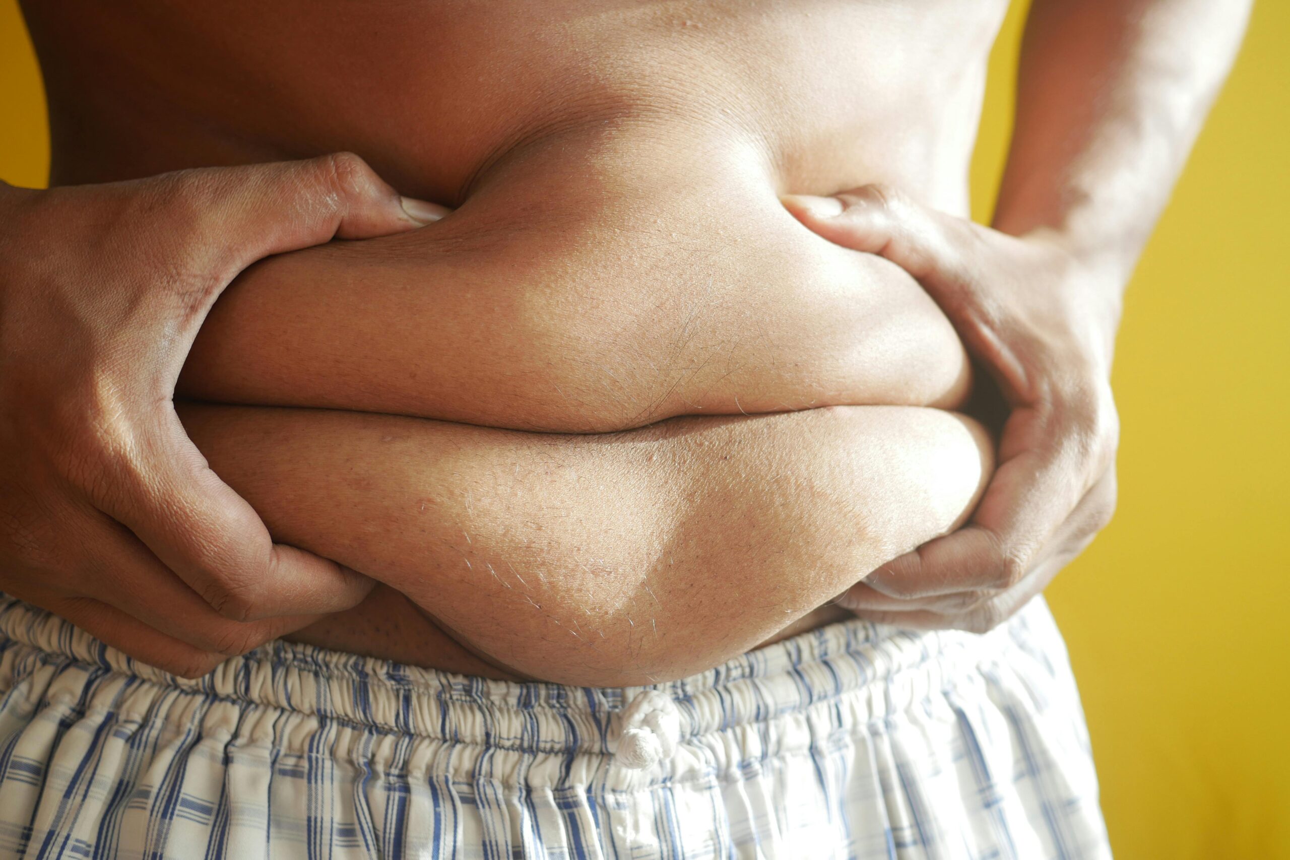 A close-up of a person's abdomen with excessive belly fat, representing the risk factors associated with cardiometabolic diseases such as obesity, diabetes, and heart disease.